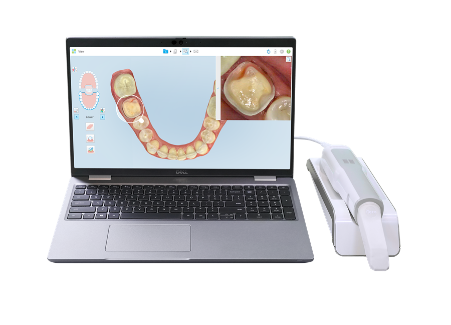 ortodonzia scanner 3d