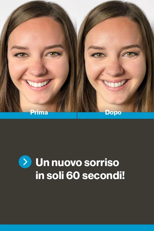 Invisalign Brindisi